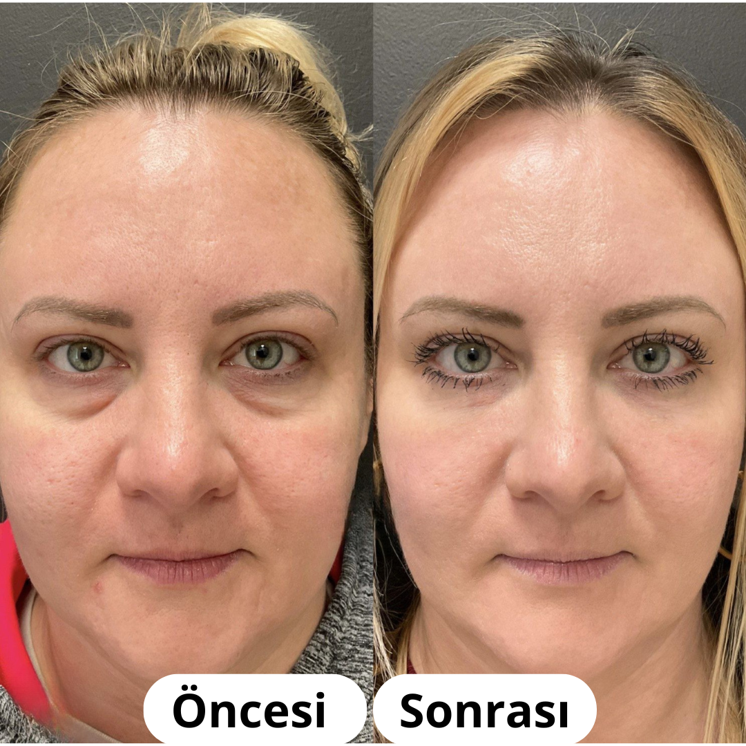 Mello™ Kollajen Maskesi