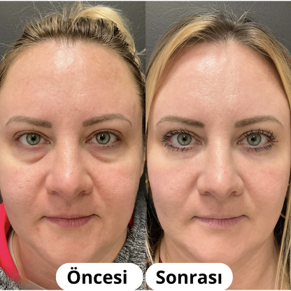 Mello™ Kollajen Maskesi